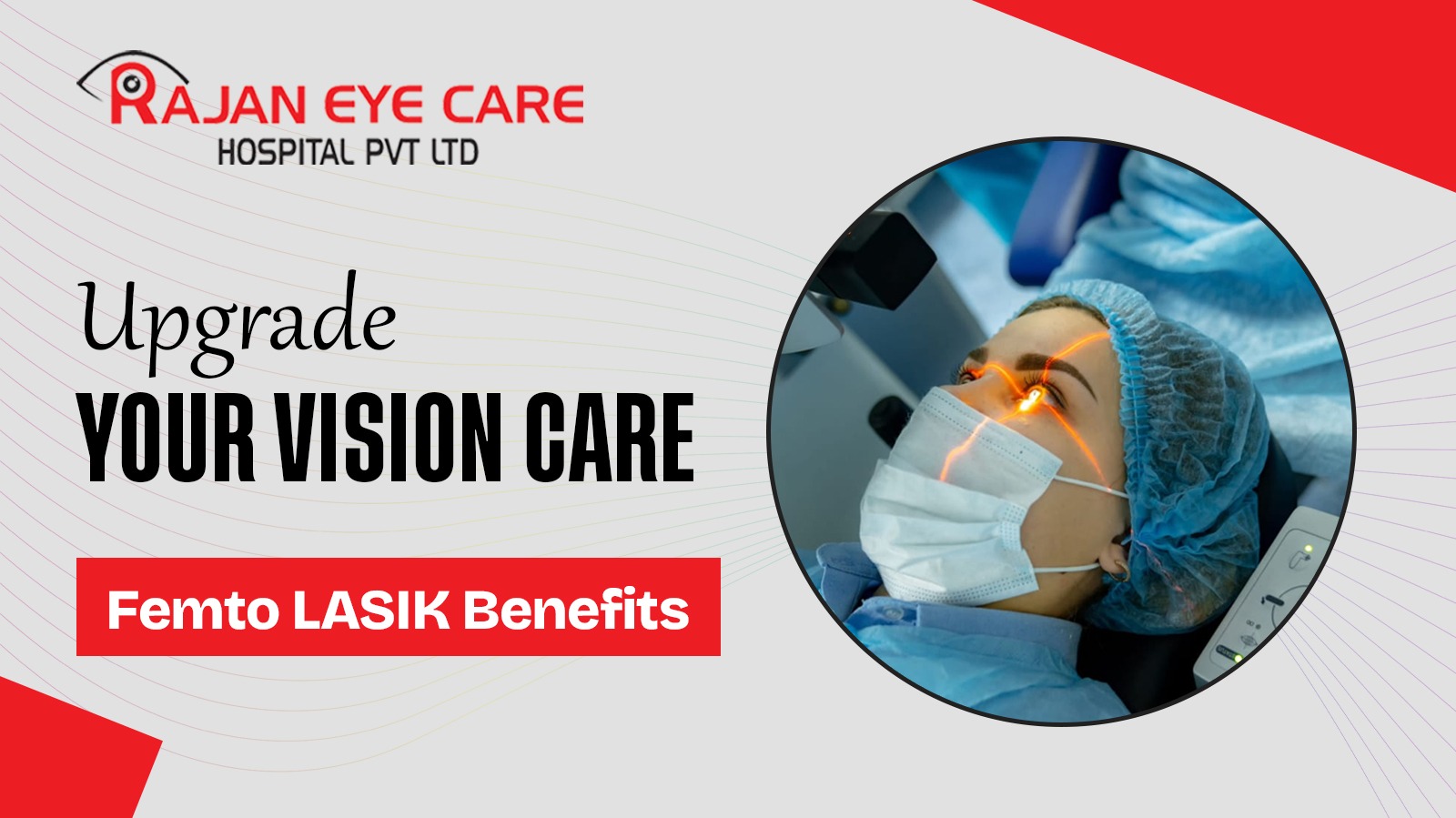 Femto contoura Lasik in Chennai